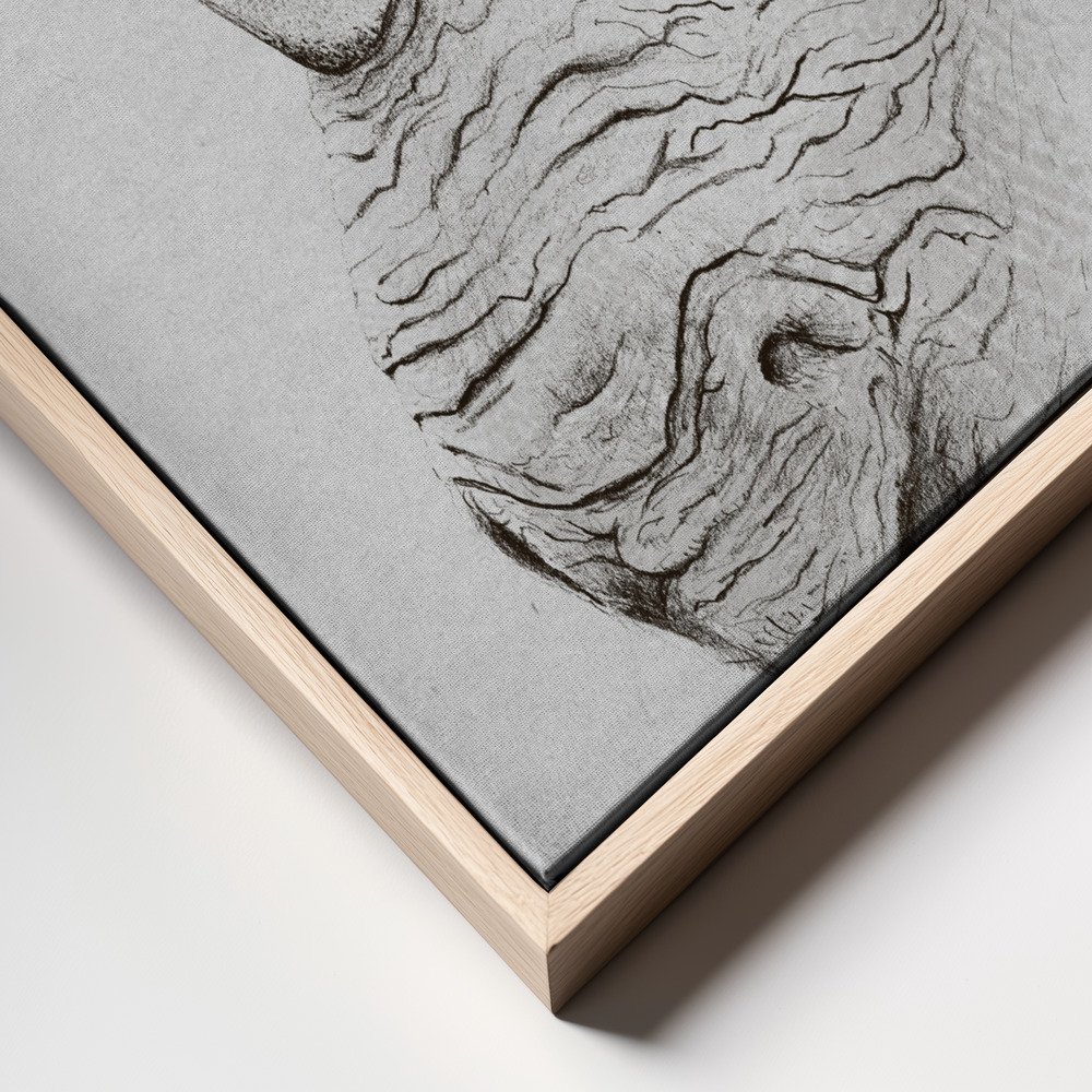 Canvas print - Rhinoplasty frame close up